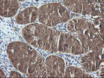 DNM1L Antibody in Immunohistochemistry (Paraffin) (IHC (P))