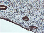 DNM1L Antibody in Immunohistochemistry (Paraffin) (IHC (P))