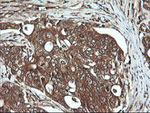 DNM1L Antibody in Immunohistochemistry (Paraffin) (IHC (P))