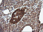 DNM1L Antibody in Immunohistochemistry (Paraffin) (IHC (P))