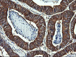 DNM1L Antibody in Immunohistochemistry (Paraffin) (IHC (P))