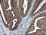 DNM1L Antibody in Immunohistochemistry (Paraffin) (IHC (P))