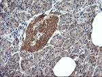 DNM1L Antibody in Immunohistochemistry (Paraffin) (IHC (P))