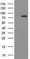 DNM1L Antibody in Western Blot (WB)