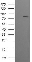 DNM1L Antibody in Western Blot (WB)