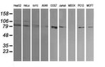 DNM1L Antibody in Western Blot (WB)