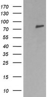 DNM1L Antibody in Western Blot (WB)