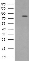 DNM1L Antibody in Western Blot (WB)