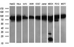 DNM1L Antibody in Western Blot (WB)