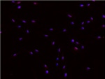 DNMT1 Antibody in Immunocytochemistry (ICC/IF)