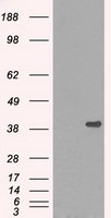 DNTTIP1 Antibody in Western Blot (WB)