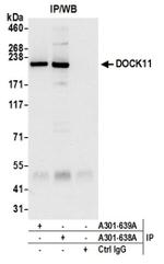 DOCK11 Antibody in Immunoprecipitation (IP)