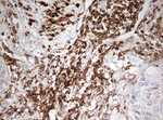 DOCK2 Antibody in Immunohistochemistry (Paraffin) (IHC (P))