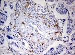 DOCK2 Antibody in Immunohistochemistry (Paraffin) (IHC (P))