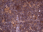 DOCK8 Antibody in Immunohistochemistry (Paraffin) (IHC (P))