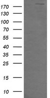 DOCK8 Antibody in Western Blot (WB)