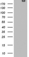 DOCK8 Antibody in Western Blot (WB)