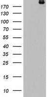 DOCK8 Antibody in Western Blot (WB)