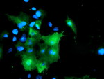 DOK7 Antibody in Immunocytochemistry (ICC/IF)