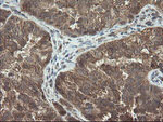 DOK7 Antibody in Immunohistochemistry (Paraffin) (IHC (P))