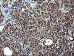 DOK7 Antibody in Immunohistochemistry (Paraffin) (IHC (P))