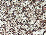 DOK7 Antibody in Immunohistochemistry (Paraffin) (IHC (P))