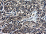 DOK7 Antibody in Immunohistochemistry (Paraffin) (IHC (P))