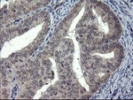 DOK7 Antibody in Immunohistochemistry (Paraffin) (IHC (P))