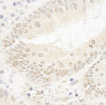 DOT1L Antibody in Immunohistochemistry (IHC)