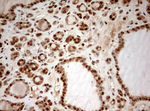 DOT1L Antibody in Immunohistochemistry (Paraffin) (IHC (P))