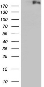 DOT1L Antibody in Western Blot (WB)