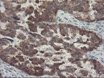 DPH2 Antibody in Immunohistochemistry (Paraffin) (IHC (P))