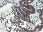 DPH2 Antibody in Immunohistochemistry (Paraffin) (IHC (P))