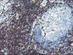 DPH2 Antibody in Immunohistochemistry (Paraffin) (IHC (P))