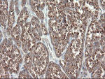 DPH2 Antibody in Immunohistochemistry (Paraffin) (IHC (P))