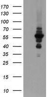 DPH2 Antibody in Western Blot (WB)