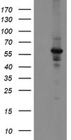 DPH2 Antibody in Western Blot (WB)