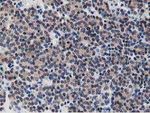 DPP3 Antibody in Immunohistochemistry (Paraffin) (IHC (P))