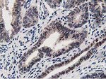 DPP3 Antibody in Immunohistochemistry (Paraffin) (IHC (P))