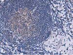 DPP3 Antibody in Immunohistochemistry (Paraffin) (IHC (P))