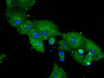 DPP4 Antibody in Immunocytochemistry (ICC/IF)