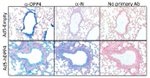 DPP4 Antibody in Immunohistochemistry (Paraffin) (IHC (P))