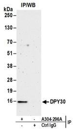 DPY30 Antibody in Immunoprecipitation (IP)