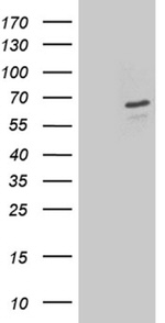 DPYSL2 Antibody in Western Blot (WB)