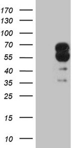 DPYSL2 Antibody in Western Blot (WB)