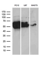 DPYSL2 Antibody in Western Blot (WB)