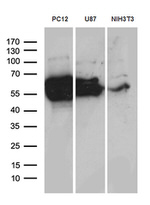 DPYSL2 Antibody in Western Blot (WB)