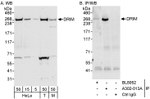 DRIM Antibody in Western Blot (WB)