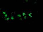 DSTN Antibody in Immunocytochemistry (ICC/IF)