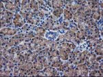 DSTN Antibody in Immunohistochemistry (Paraffin) (IHC (P))